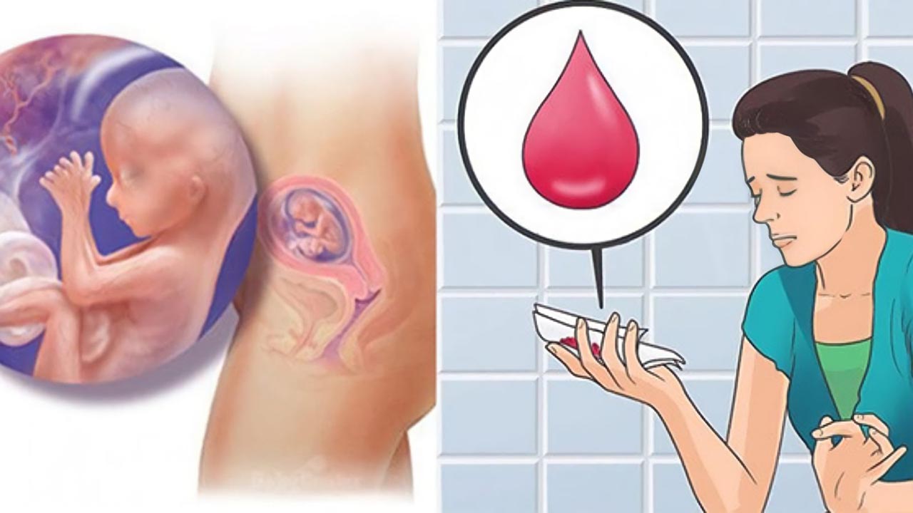 Có những biện pháp phòng ngừa để tránh việc ra máu sau sảy thai không?
