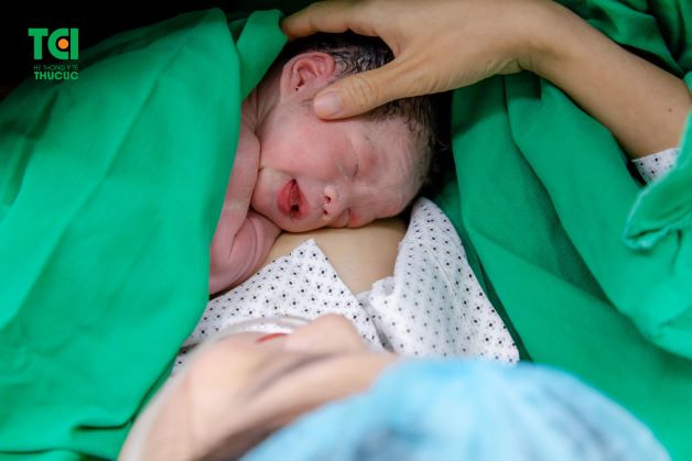 Chị Hạnh và em bé kề da ngay sau sinh mổ thai nhi bị thắt nút dây rốn