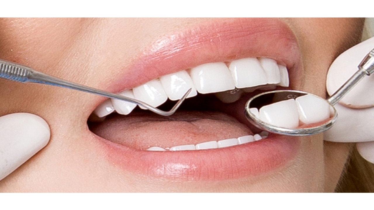 Chăm sóc răng sứ và những lưu ý không thể bỏ qua