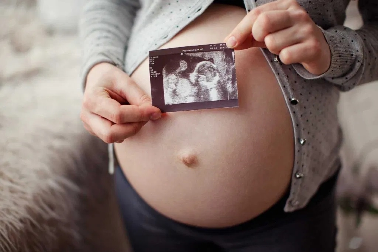 Khi nào nên thực hiện siêu âm thai trong thai kỳ và tại sao?
