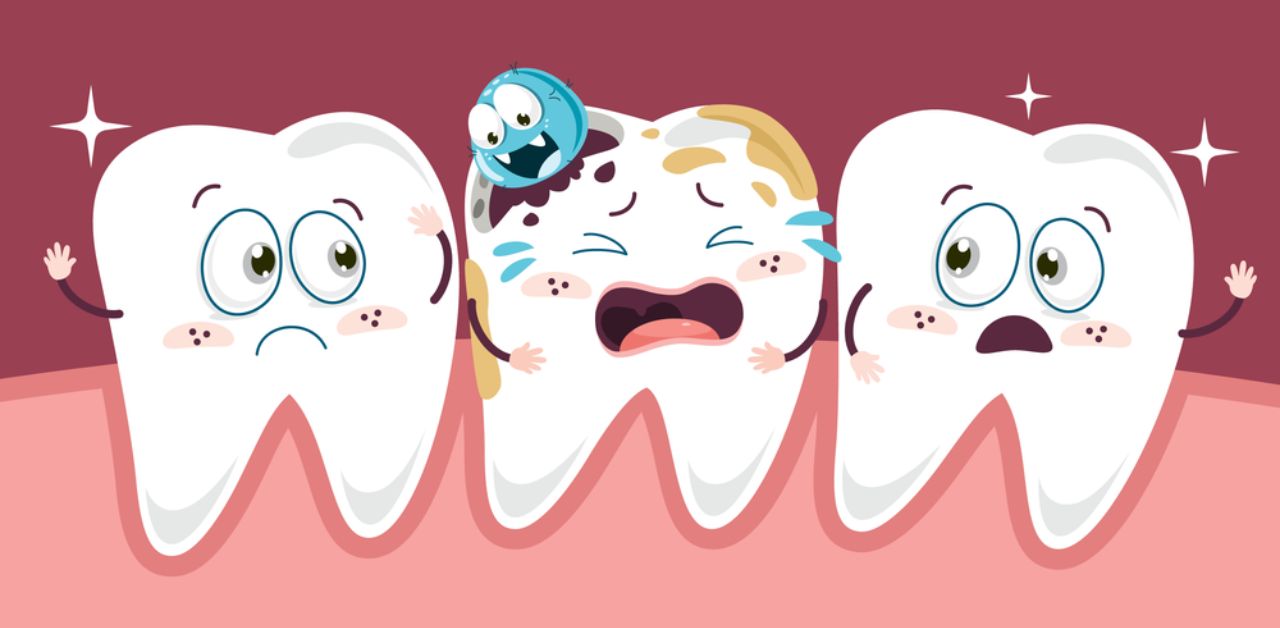 Tác động của răng sâu nặng đến thẩm mỹ răng miệng?
