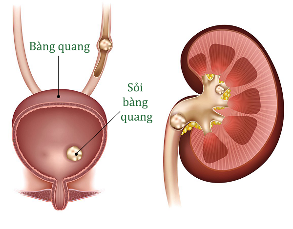 soi bang quang