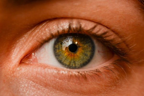 Tăng nhãn áp là tình trạng tổn thương thị trường mắt dẫn tới lõm teo địa thị và gia tăng áp suốt trong mắt