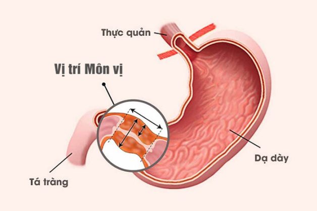 tri viem da day ta trang2 e1669004078794