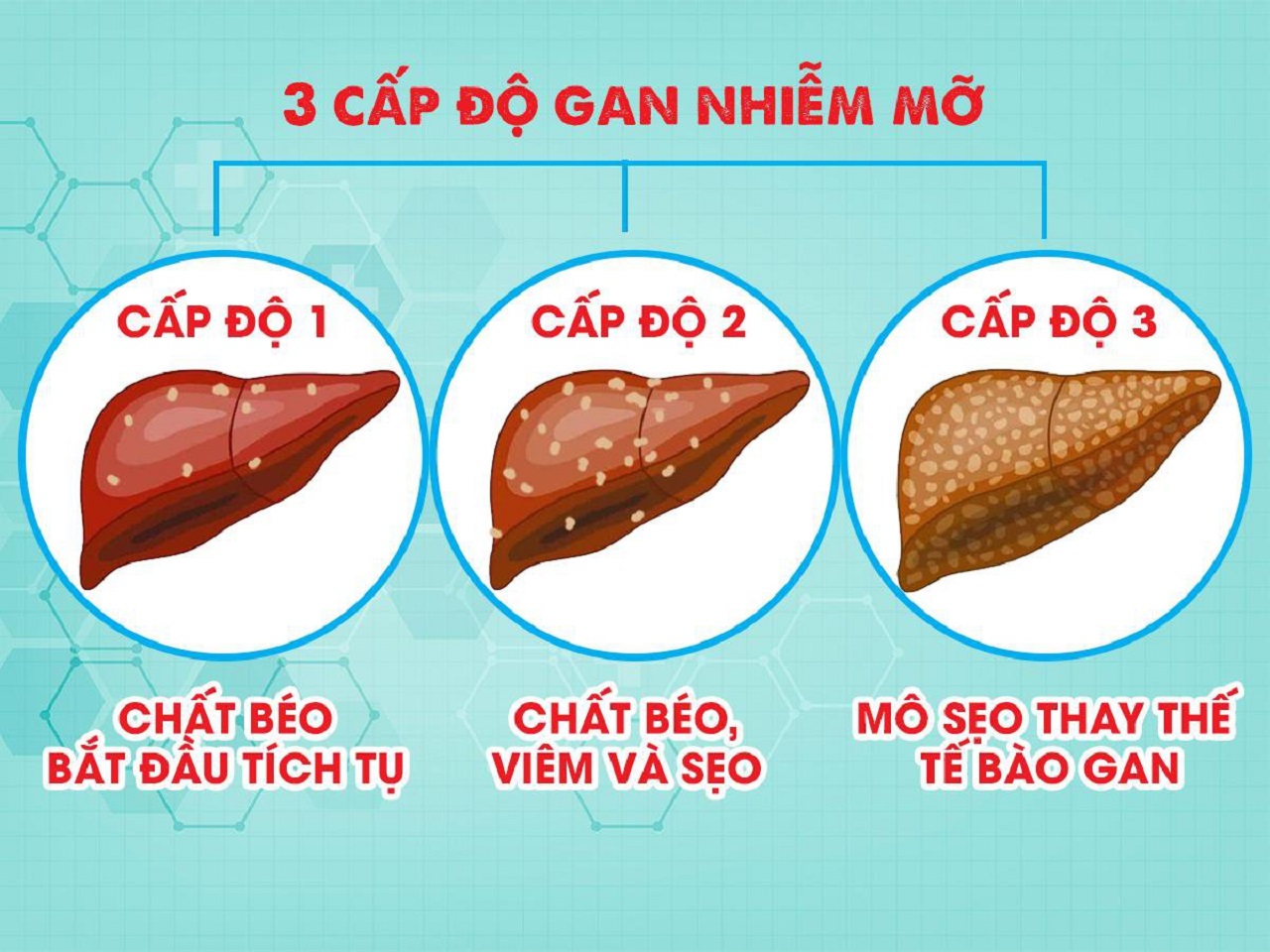 3. Lời khuyên từ chuyên gia