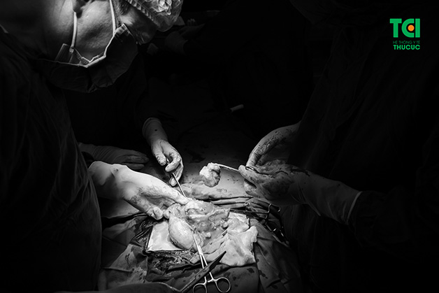 Phẫu thuật là phương án giúp loại bỏ nhân xơ tử cung, ngăn chặn các biến chứng có thể xảy ra