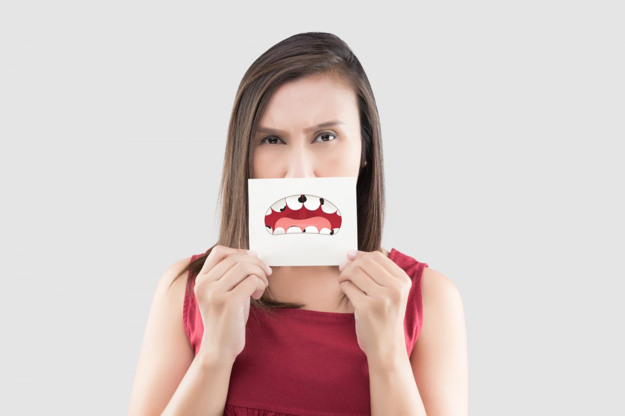 Khi nào cần điều trị phục hình răng sâu, bể, vỡ?
