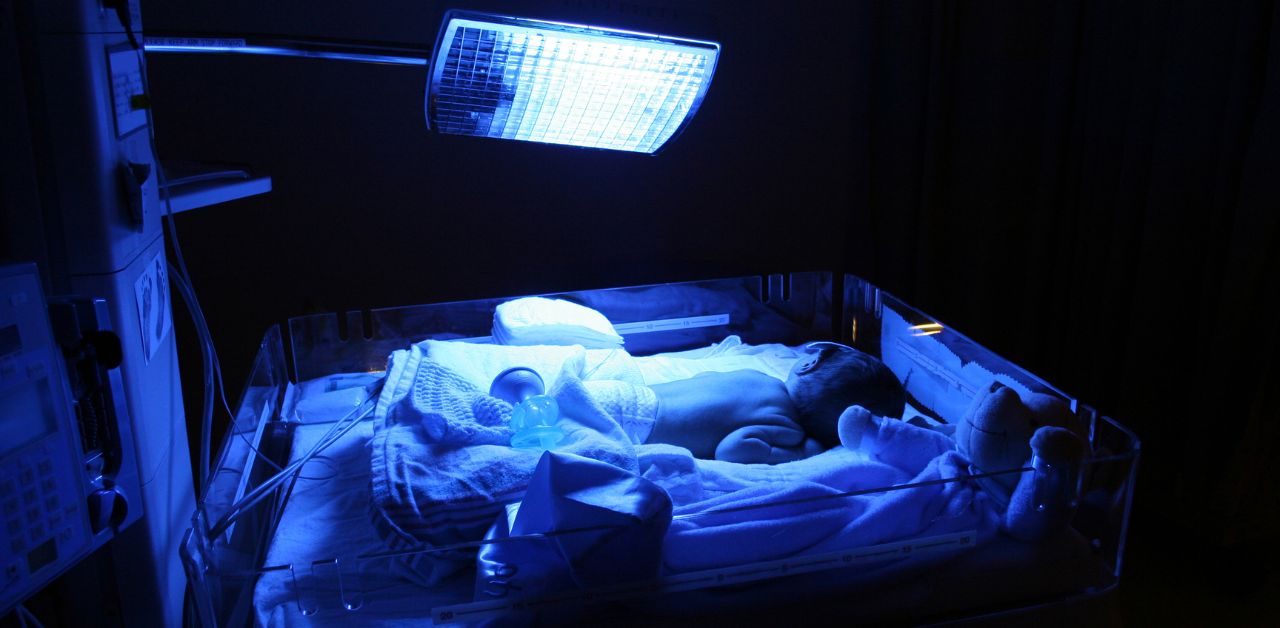 Trẻ sơ sinh bị vàng da kéo dài là do đâu? | TCI Hospital