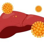(Dantri) Nguy cơ ung thư gan ở nhóm người nhiễm HIV vì virus viêm gan C