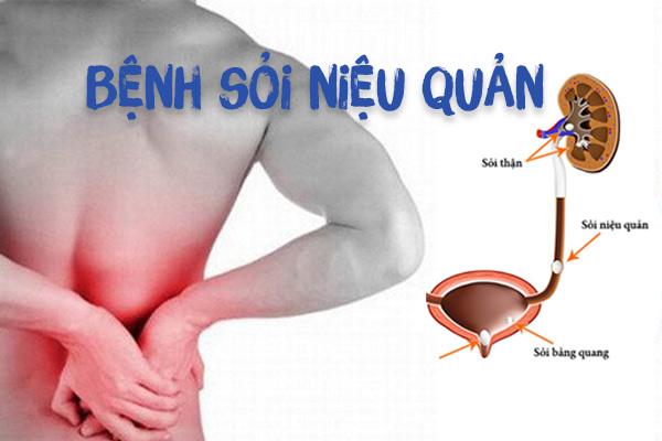 20210822 soi nieu quan 11