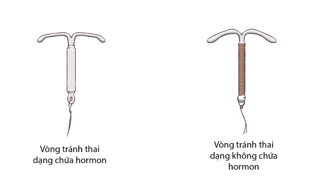 Dây Vòng Tránh Thai Làm Bằng Chất Liệu Gì? Tìm Hiểu Ngay!