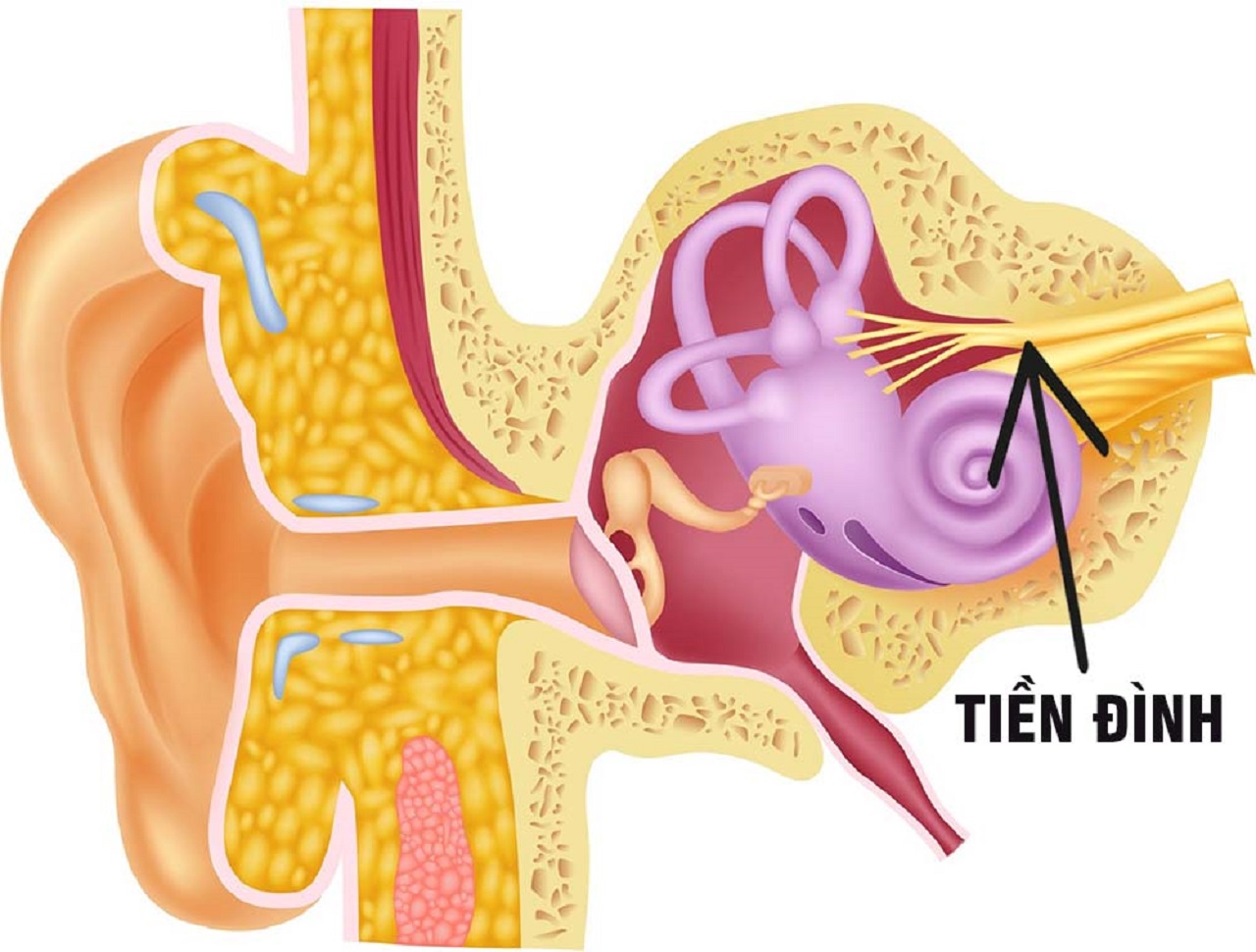 Viêm dây thần kinh ốc tai: Triệu chứng, nguyên nhân và cách điều trị