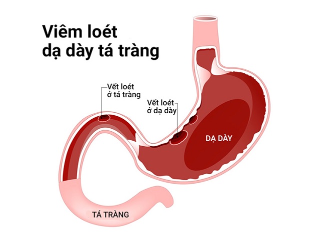 hien tuong dau da day ta trang 2 1