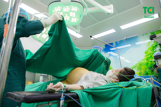 Đẻ mổ là một trong những phương pháp sinh nở được ứng dụng phổ biến hiện nay, giúp mẹ bầu sinh nở thuận lợi hơn