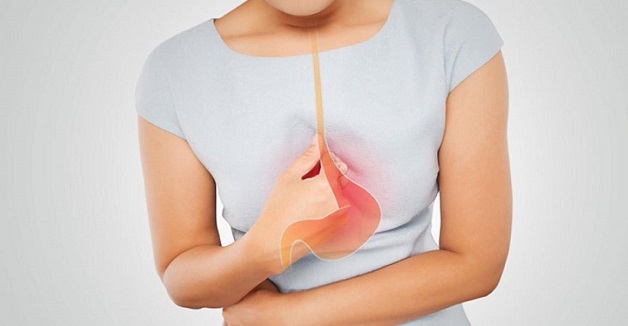 K21 là bệnh gì trào ngược thực quản