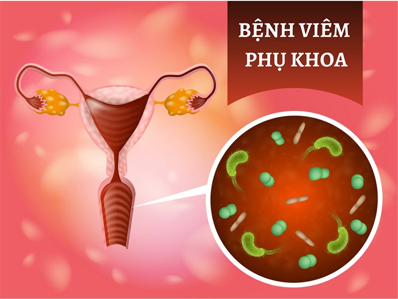 Quan hệ tình dục khi bị viêm nhiễm phụ khoa có được không?