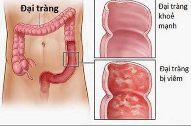 3. Các Phương Pháp Điều Trị