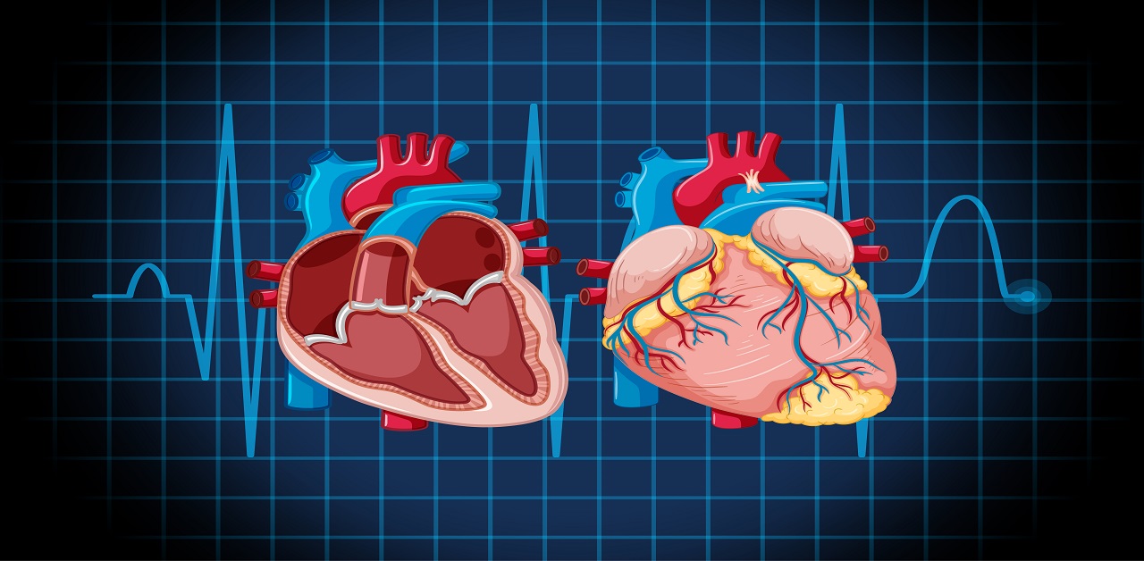 Yếu tố nguy cơ nào có thể làm tăng nguy cơ đứt dây chằng van tim?
