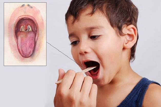 vắc xin bạch hầu mang lại nhiều lợi ích