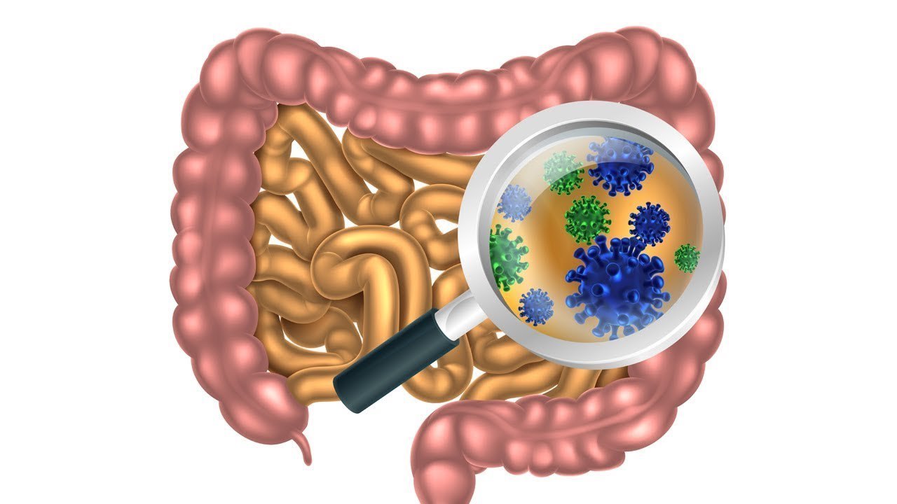 Cách phòng ngừa IBD là gì?
