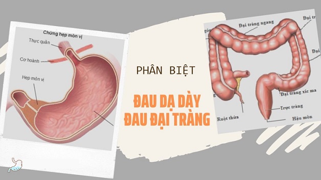 4. Nguyên nhân gây đau dạ dày và đại tràng