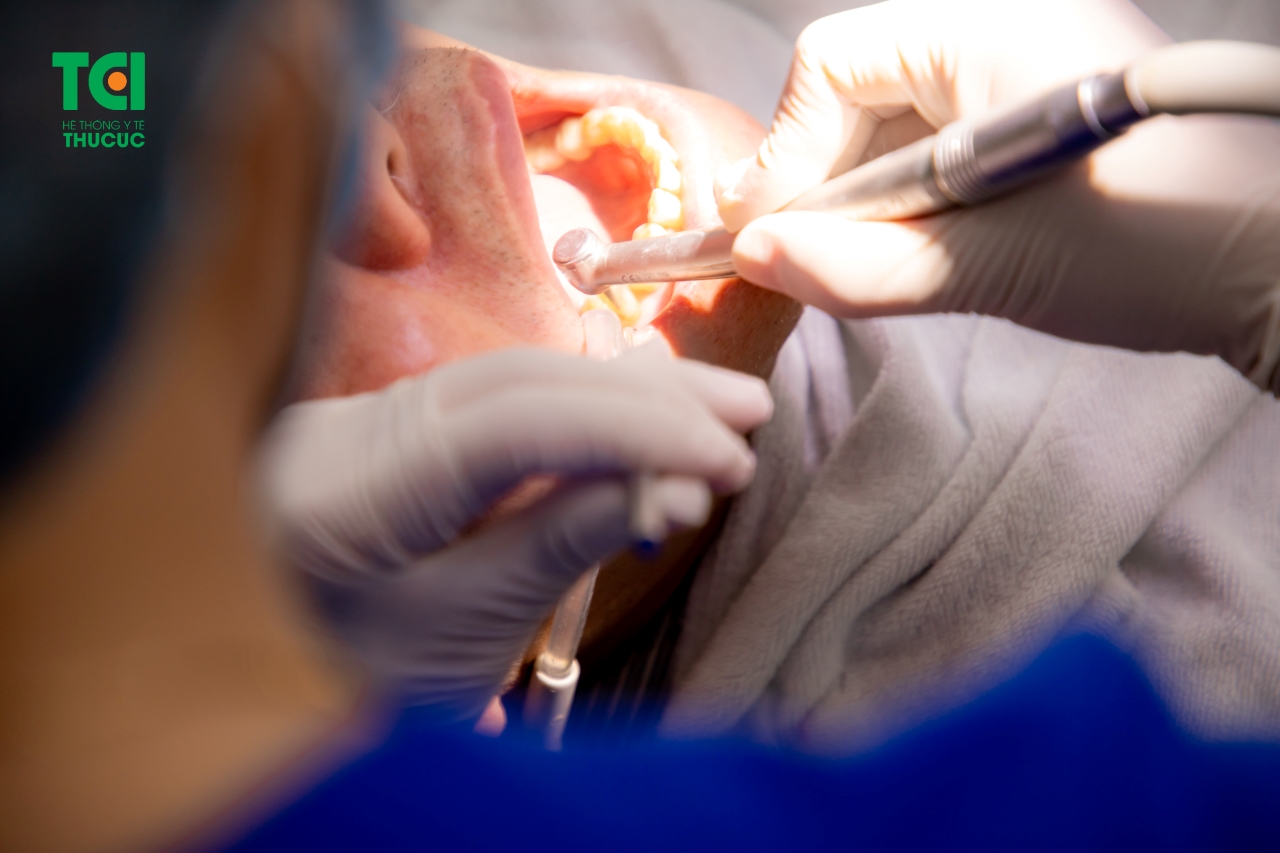 Các biểu hiện và cách phòng ngừa răng mòn cổ là gì?