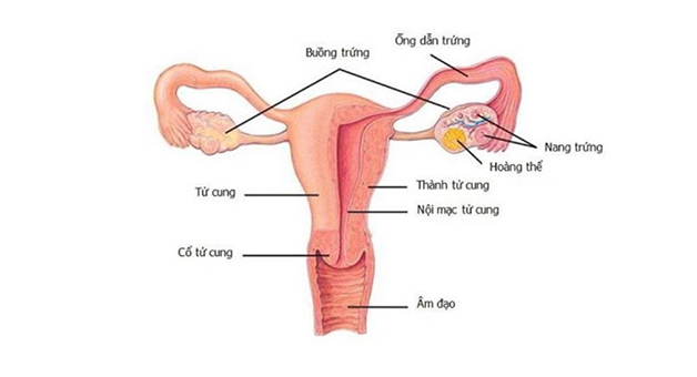Nang hoàng thể buồng trứng là một dạng u nang buồng trứng lành tính và thường không gây hại