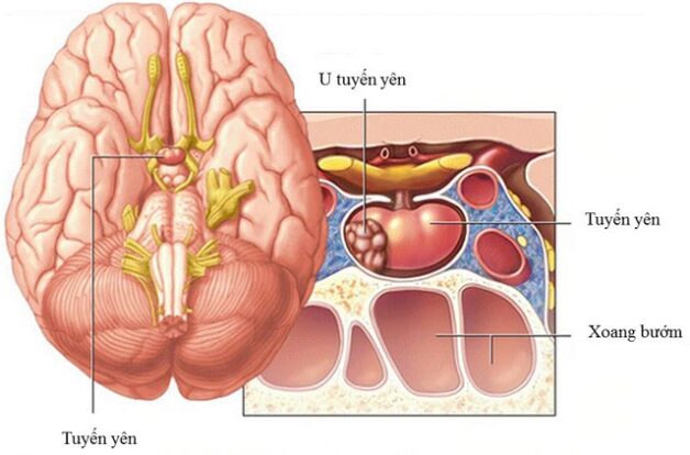 7. Cách phòng ngừa và theo dõi sau điều trị