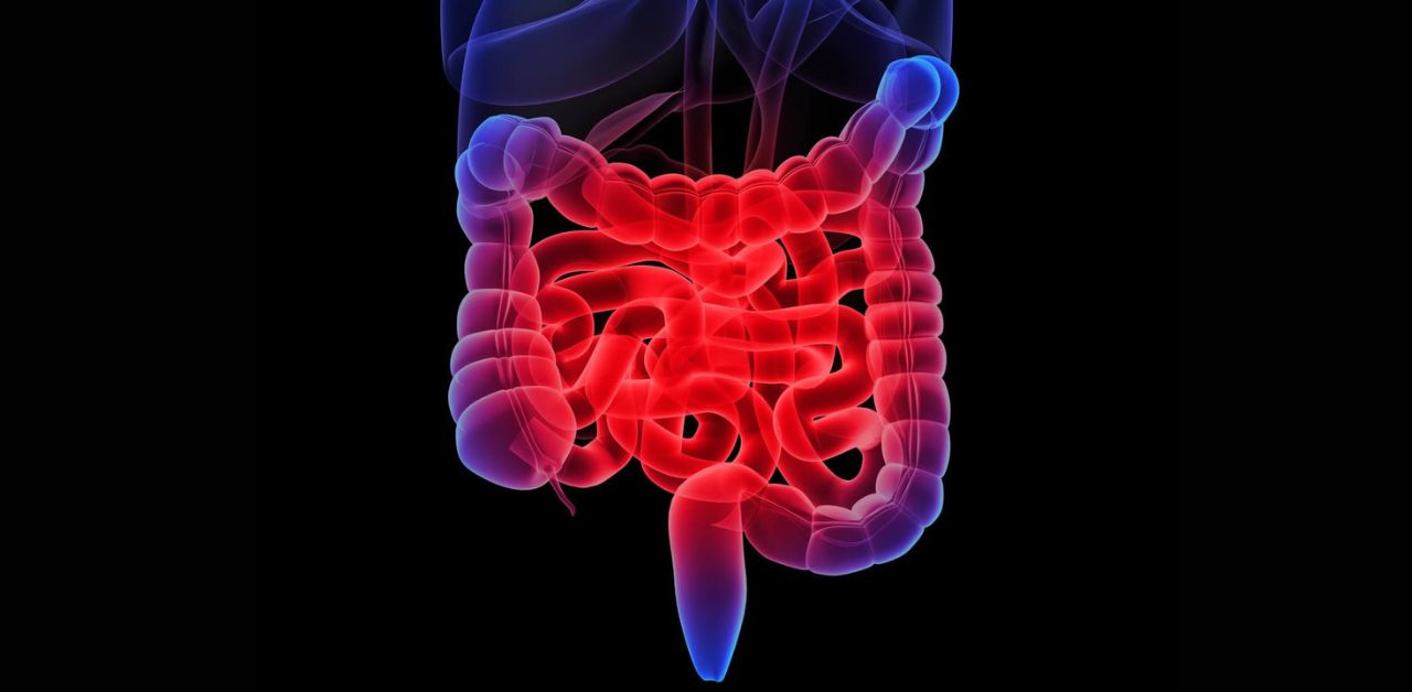 IBD có cách điều trị nào không?
