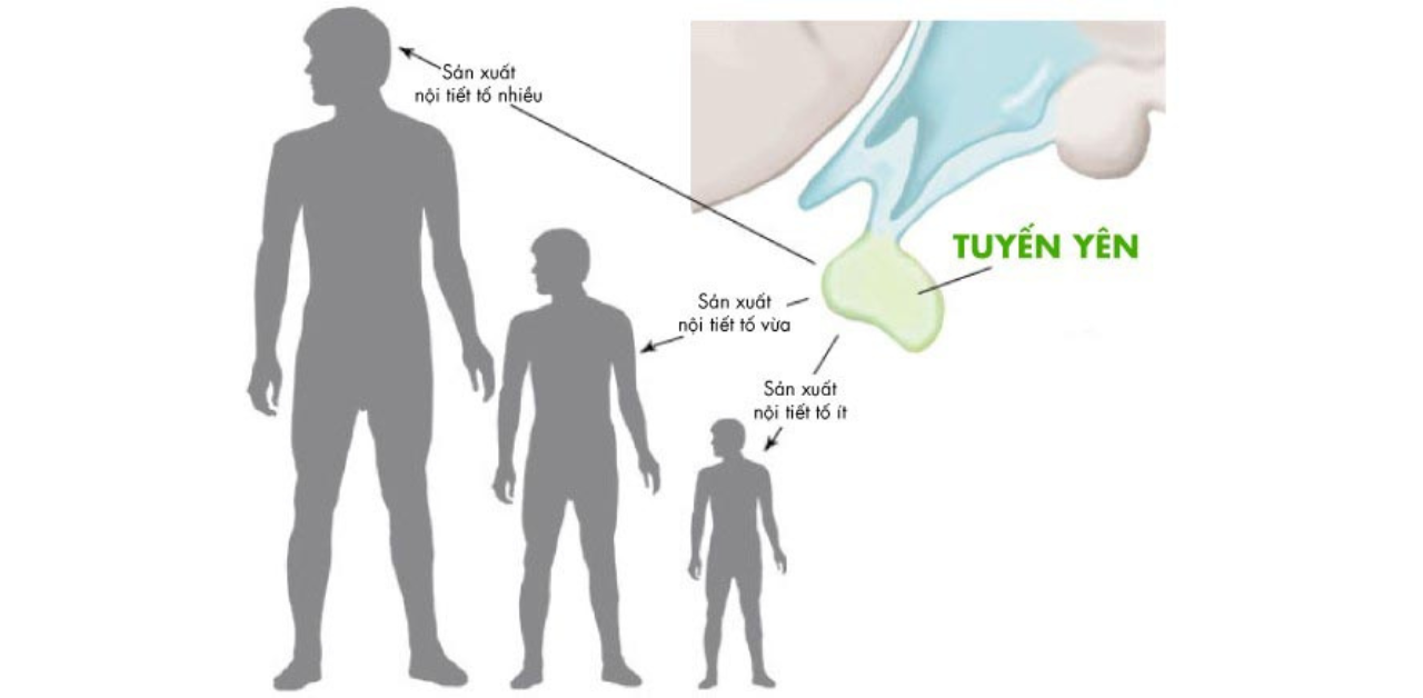 Có những thực phẩm nào nên tránh khi có vấn đề về tuyến yên?
