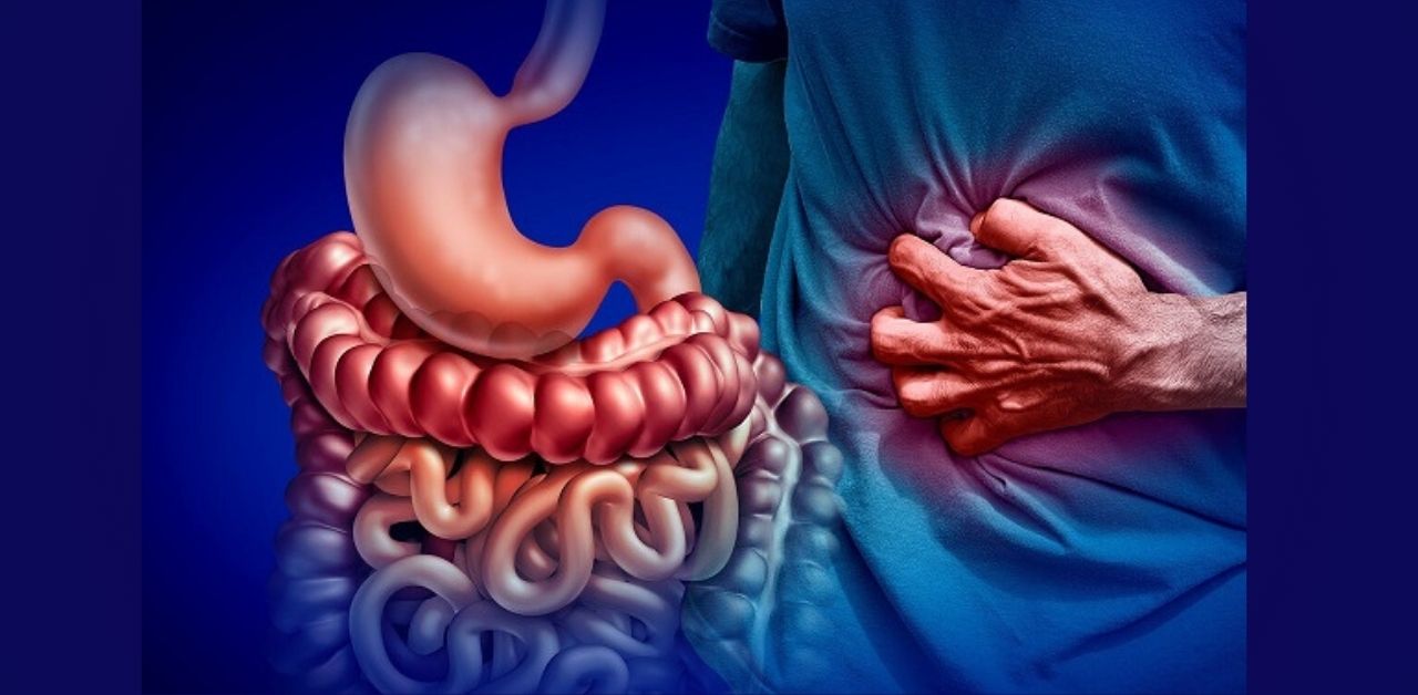 Không có phương pháp điều trị cứng nhắc nào cho bệnh Crohn, nhưng có những biện pháp hỗ trợ nào để giảm triệu chứng của bệnh?
