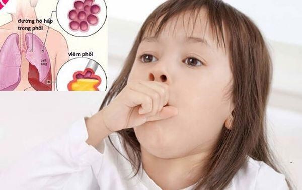 bé bị viêm phổi