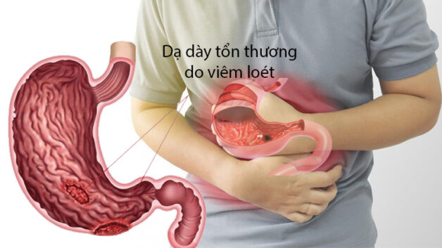 dau da day nen kieng thuc an cay 16618820208842009952337 e1684479364283