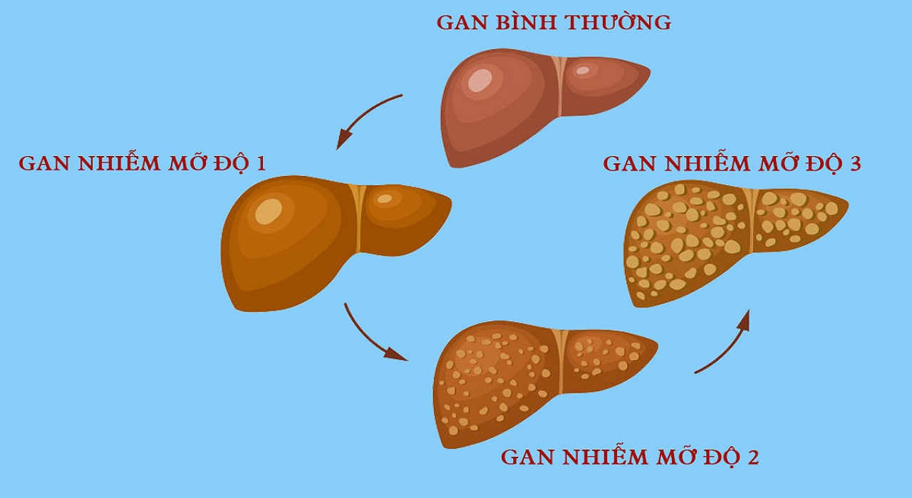 Phương Pháp Chẩn Đoán