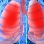 Tìm hiểu ưu – nhược điểm của siêu âm màng phổi