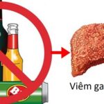Viêm gan do rượu có phải bệnh nguy hiểm không?