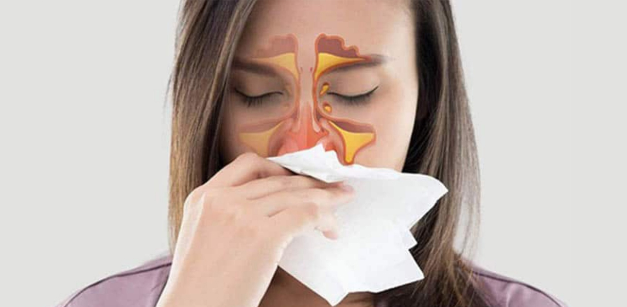 Thực hiện bao lâu và bao nhiêu lần mỗi ngày để đạt được kết quả tốt nhất khi chữa viêm xoang mũi tại nhà?