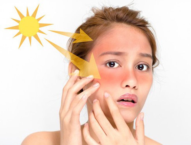 Tránh tiếp xúc ánh nắng trực tiếp để hạn chế nám da sau đặt vòng tránh thai