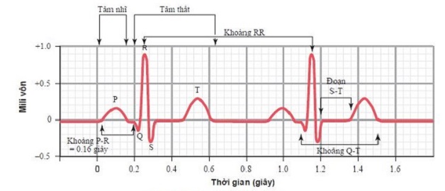 Kết quả điện tim bình thường