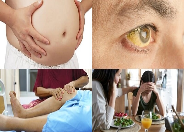 Gan nhiễm mỡ là bệnh gì và có các biểu hiện nào