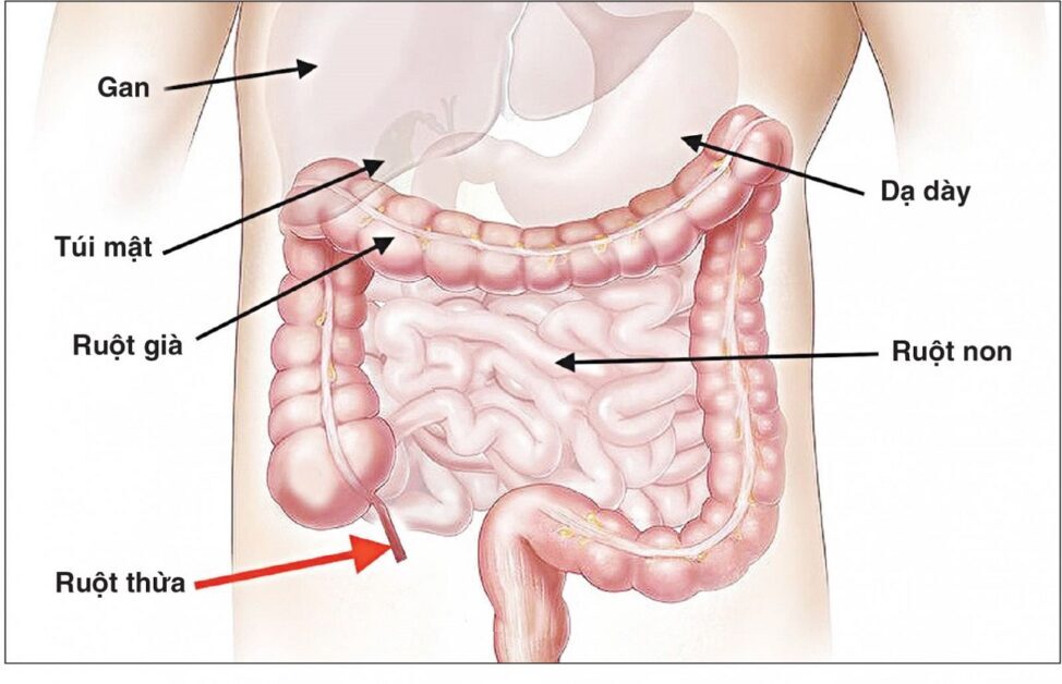 Phòng Ngừa Viêm Ruột Non