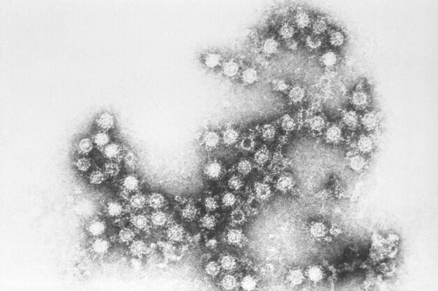 Coxsackievirus (A16) gây bệnh tay chân miệng trẻ em.