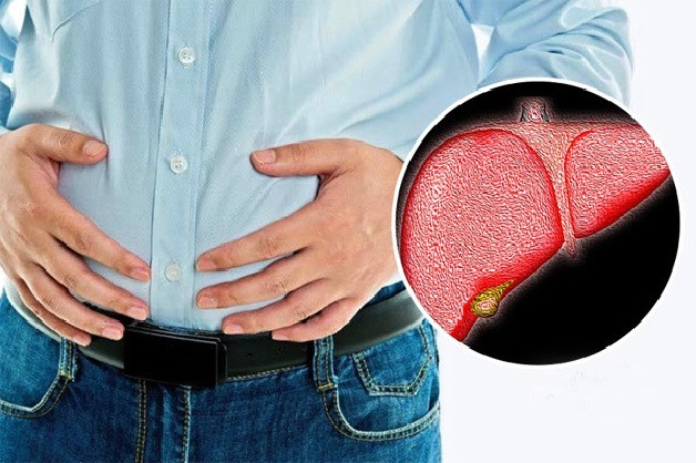 Người bệnh thường có triệu chứng đau và khó chịu ở vùng bụng phía trên bên phải