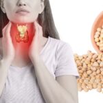 Thực hư bệnh tuyến giáp kiêng đậu nành