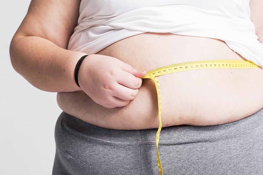 Người bệnh béo phì có nguy cơ bị trĩ cao hơn người bình thường