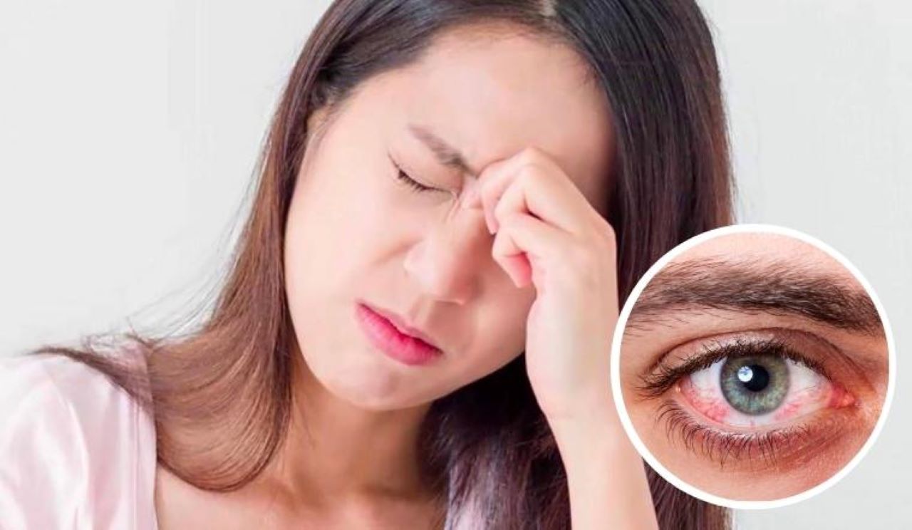 đau mắt đỏ khi mang thai có tái nhiễm không