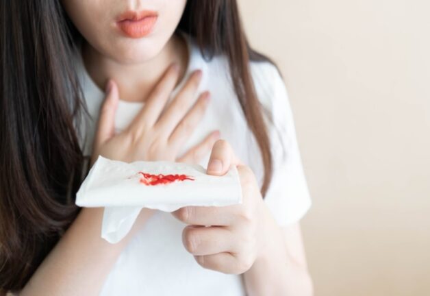 Xơ gan vỡ tĩnh mạch thực quản gây ra triệu chứng nôn, ho hoặc đại tiện ra máu