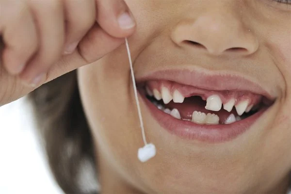 Trẻ nào cũng có lộ trình thay răng nhất định