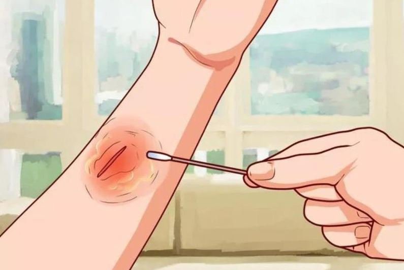 Vi khuẩn fun88 contact có thể tấn công mẹ bầu thông qua những vết thương hở và qua quá trình sinh nở