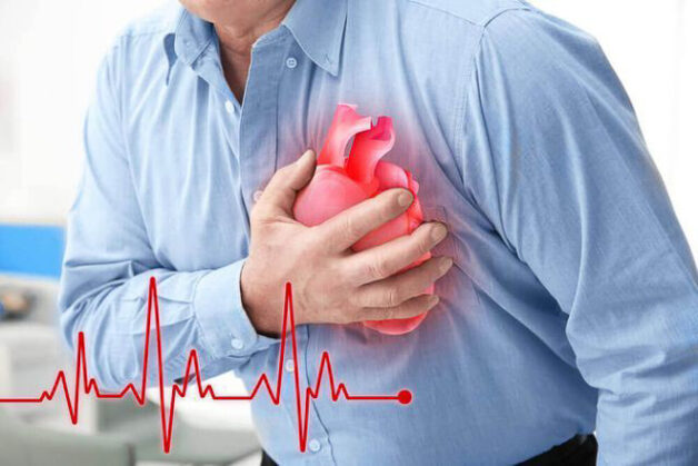 đột quỵ và tình trạng giảm tuổi thọ